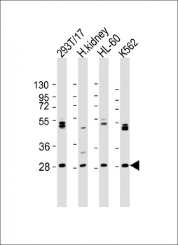 ARV1 Antibody