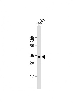 ARV1 Antibody