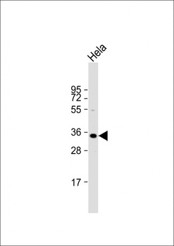 ARV1 Antibody