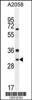 ARV1 Antibody