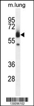 ZUFSP Antibody