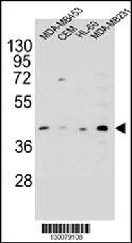 HHLA2 Antibody