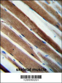 CCDC38 Antibody