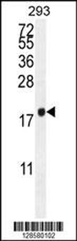 PCOTH Antibody