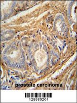 C1QTNF9B-AS1 Antibody