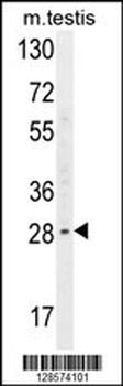 YDJC Antibody