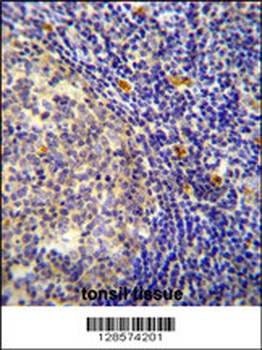 YDJC Antibody