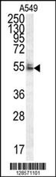 DCAF10 Antibody