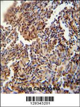 HFM1 Antibody