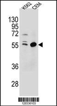 TEX9 Antibody