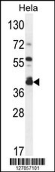 DEGS2 Antibody