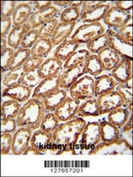 DEGS2 Antibody