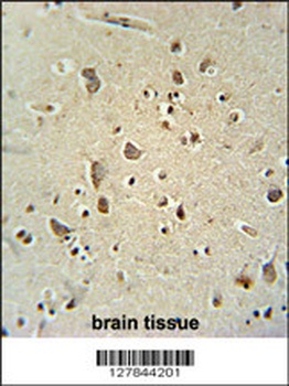 CARNS1 Antibody