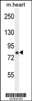 ZFYVE28 Antibody