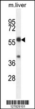 TBCCD1 Antibody