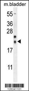 NXNL2 Antibody