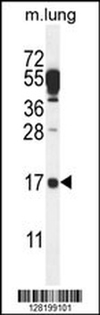 DTD2 Antibody