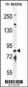 IFT81 Antibody