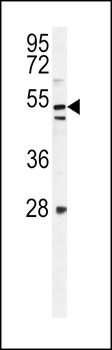 KIAA1609 Antibody