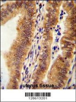 KIAA1609 Antibody