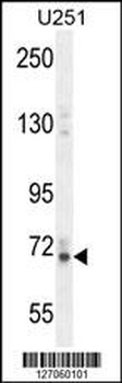 VIT Antibody