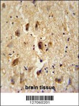VITRN Antibody