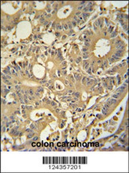 TPSD1 Antibody