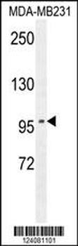 ST7 Antibody