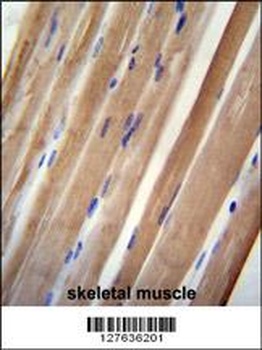 INPP5B Antibody