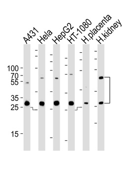 CTSA Antibody