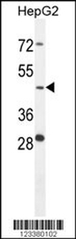 CTSA Antibody