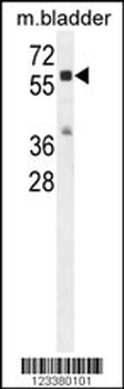 CTSA Antibody