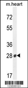 B3GAT2 Antibody