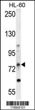 ABCD1 Antibody