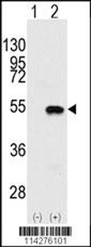 SMYD2 Antibody