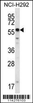 SMYD2 Antibody