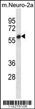 SMYD2 Antibody