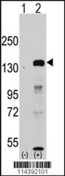 JHDM1a/FBXL11 Antibody
