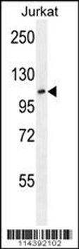 JHDM1a/FBXL11 Antibody