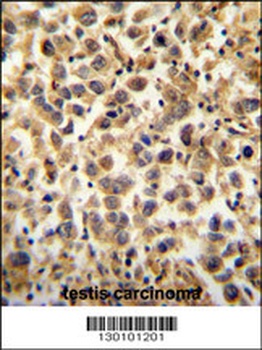 CFAP45 Antibody