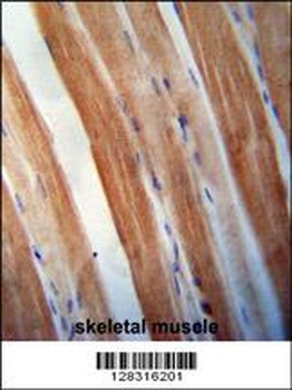 KBTBD5 Antibody