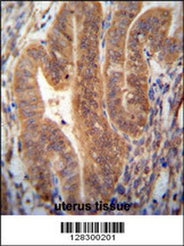 KIAA1644 Antibody