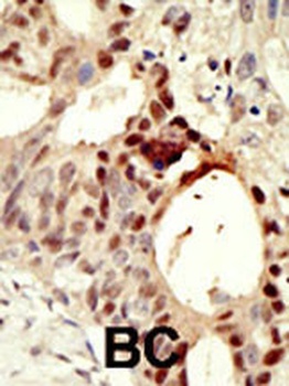 DNMT3L Antibody