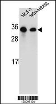 SAR1B Antibody