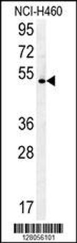 DENND1B Antibody