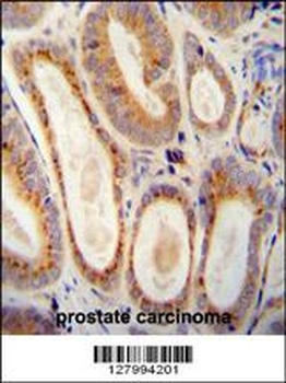 WFDC12 Antibody