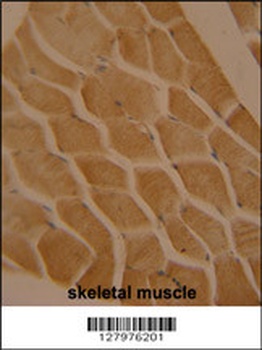 LMOD2 Antibody