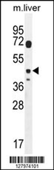 DTWD2 Antibody