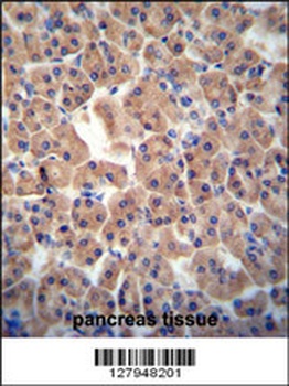 CTU1 Antibody