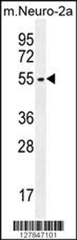 ZDHHC1 Antibody